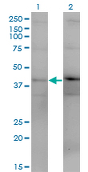 DUSP4 monoclonal antibody (M08), clone 1D12