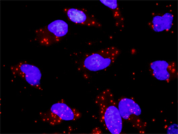 DUSP4 purified MaxPab rabbit polyclonal antibody (D01P)