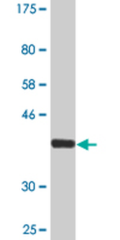 DTYMK monoclonal antibody (M01A), clone 2C2