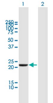 DTYMK purified MaxPab mouse polyclonal antibody (B01P)