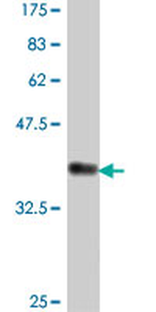 DTYMK polyclonal antibody (A01)