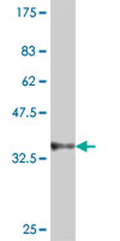 DTNB polyclonal antibody (A01)