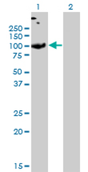 SLC26A2 monoclonal antibody (M04), clone 3F6