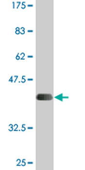 SLC26A2 monoclonal antibody (M04), clone 3F6