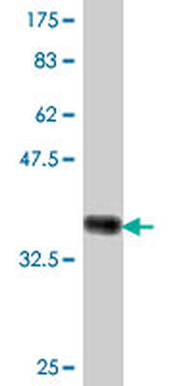 TSC22D3 polyclonal antibody (A01)
