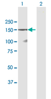 DSG1 purified MaxPab mouse polyclonal antibody (B01P)