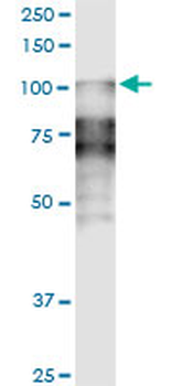 DSC2 monoclonal antibody (M14), clone 1F2