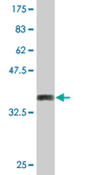 DSC2 monoclonal antibody (M14), clone 1F2