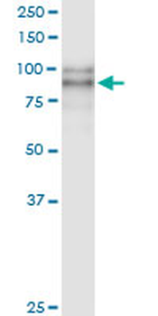 DSC2 MaxPab rabbit polyclonal antibody (D01)