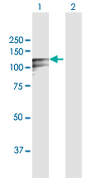 DSC2 MaxPab rabbit polyclonal antibody (D01)