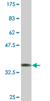 DRD2 monoclonal antibody (M01A), clone 1B11
