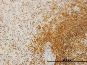 SLC26A3 monoclonal antibody (M01), clone 2E3