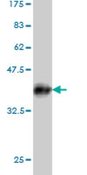 SLC26A3 monoclonal antibody (M01), clone 2E3