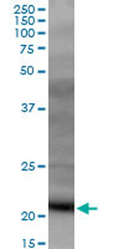 DR1 MaxPab mouse polyclonal antibody (B01)