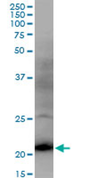 DR1 MaxPab mouse polyclonal antibody (B01)