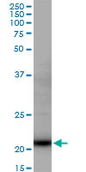 DR1 MaxPab mouse polyclonal antibody (B01)
