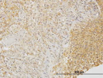 DPYSL3 monoclonal antibody (M01), clone 1B8