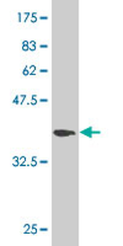 DPYSL3 monoclonal antibody (M01), clone 1B8