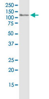 DPYD monoclonal antibody (M01J), clone 7D4