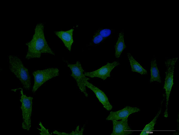 DPYD monoclonal antibody (M01J), clone 7D4