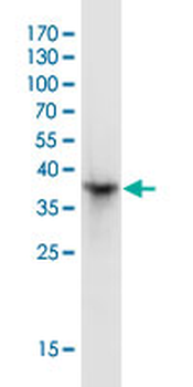 DPYD monoclonal antibody (M01J), clone 7D4