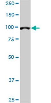 DPYD monoclonal antibody (M01), clone 7D4