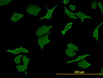 DPYD monoclonal antibody (M01), clone 7D4