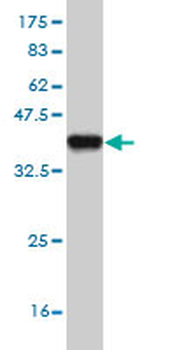 DPYD monoclonal antibody (M01), clone 7D4