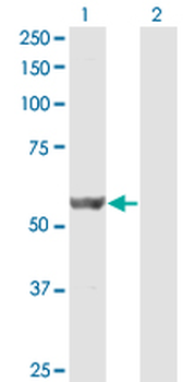 DPH2 monoclonal antibody (M07), clone 3F7