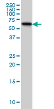 DPH2 monoclonal antibody (M02), clone 5B10