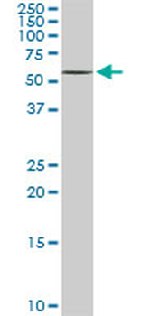 DPH2 monoclonal antibody (M02), clone 5B10