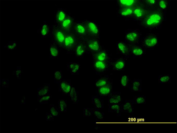 DPH2 monoclonal antibody (M02), clone 5B10