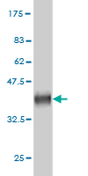 DPH2 monoclonal antibody (M02), clone 5B10