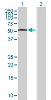 DPH2 MaxPab mouse polyclonal antibody (B01P)