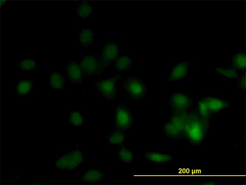 DPH1 monoclonal antibody (M02), clone 2C5