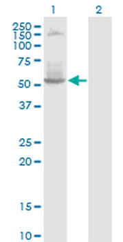 DNTT monoclonal antibody (M01), clone 4H5