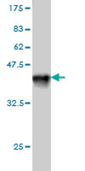 DNTT monoclonal antibody (M01), clone 4H5