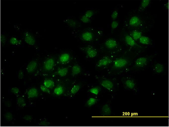 DNMT2 monoclonal antibody (M01), clone 1E12