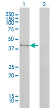 DNMT2 monoclonal antibody (M01), clone 1E12