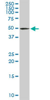 TRDMT1 purified MaxPab rabbit polyclonal antibody (D01P)