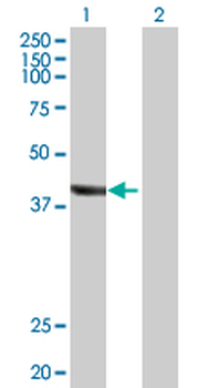 TRDMT1 purified MaxPab rabbit polyclonal antibody (D01P)