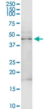 TRDMT1 MaxPab rabbit polyclonal antibody (D01)