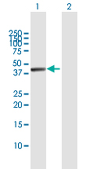 TRDMT1 MaxPab rabbit polyclonal antibody (D01)