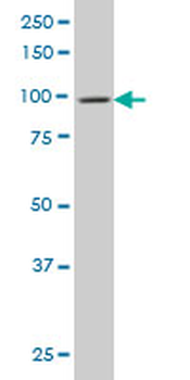 DNM2 monoclonal antibody (M01), clone 6C9