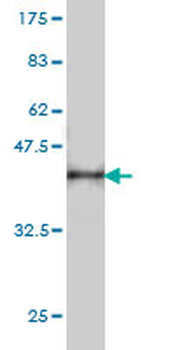 DNM2 monoclonal antibody (M01), clone 6C9