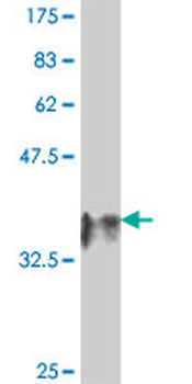 DNASE2 polyclonal antibody (A01)
