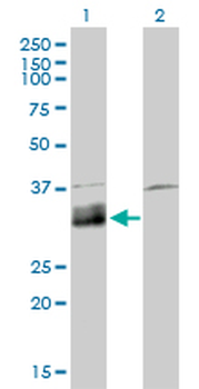 DNASE1L1 monoclonal antibody (M02), clone 4E8