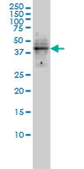 DMRT1 monoclonal antibody (M01), clone 1G11