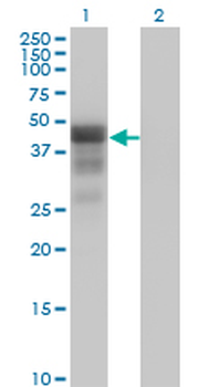 DMRT1 monoclonal antibody (M01), clone 1G11