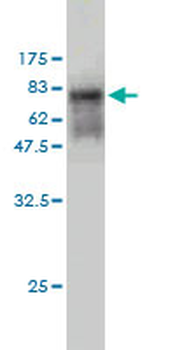 DMRT1 monoclonal antibody (M01), clone 1G11